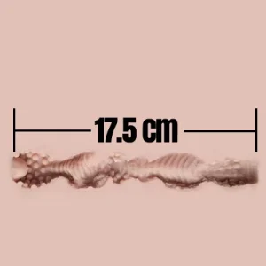17.5cm