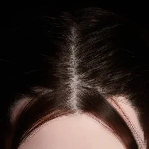 Implanted Hair