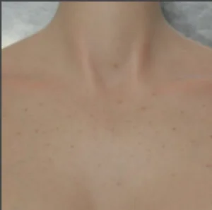 Body Freckles